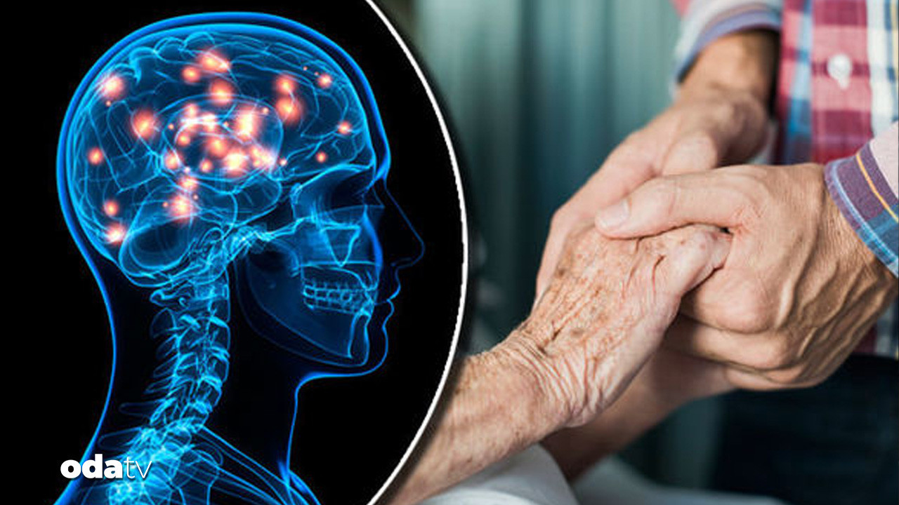 huntington hastaliginda yeni terapi yuzde 75 yavaslama jakvMmvP