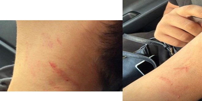 ankarada okulda siddet kiz ogrenci erkek arkadasini tokatladi tirnakladi kV5i9Cv1.jpg